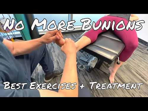 How to Relieve Bunion Pain During Exercise.