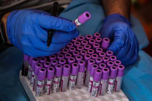 OneCell Diagnostics bags $16M to help limit cancer reoccurrence using AI | TechCrunch