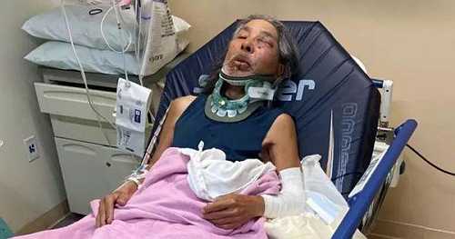 Professor Who Teaches the History of Racism Brutally Attacked in Possible Hate Crime